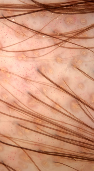 Specialist Hair Loss Clinic